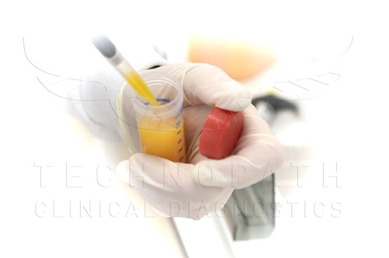 Triglyceride Extract